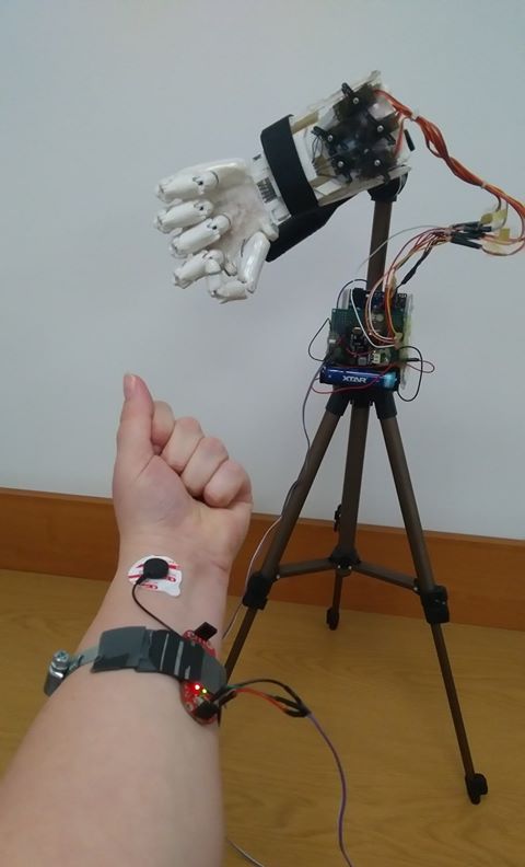 Elektroniczna proteza ręki