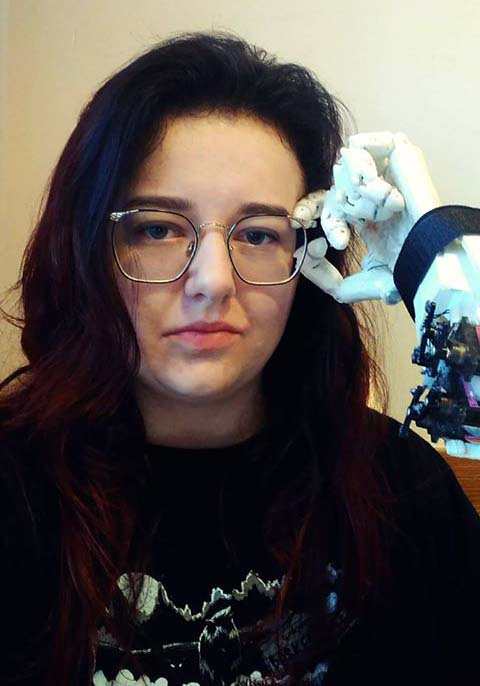 Agnieszka Tkaczyk z protezą ręki podtrzymującą okulary